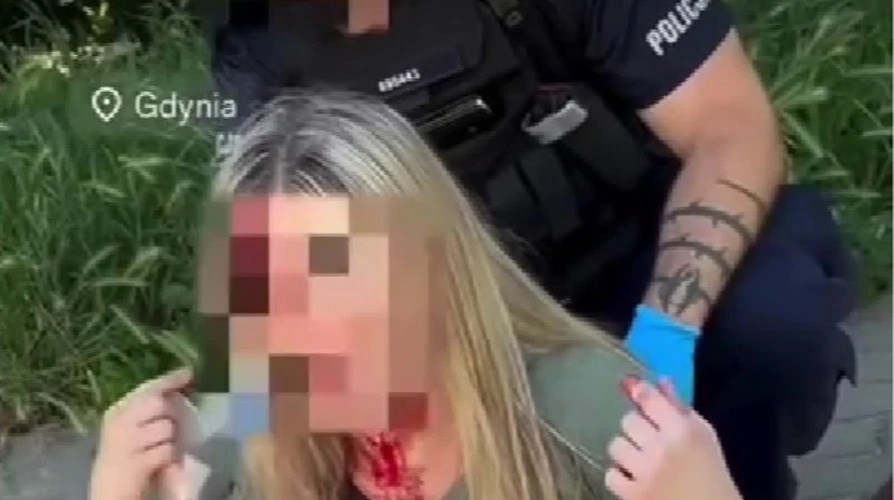 Гдиня: напад на українку 30 липня — що поліція каже про мотив